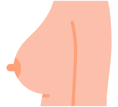 Breast illustration