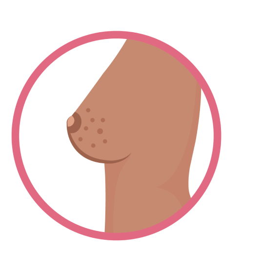 Nipple illustration